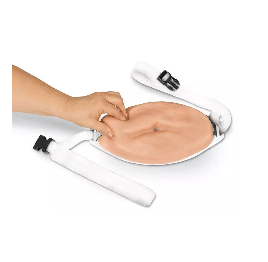 Erweiterter Injektionsbauch - Erler - Zimmer